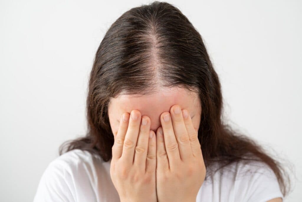 Hair Loss in Women: Breaking the Silence and Tackling Taboo