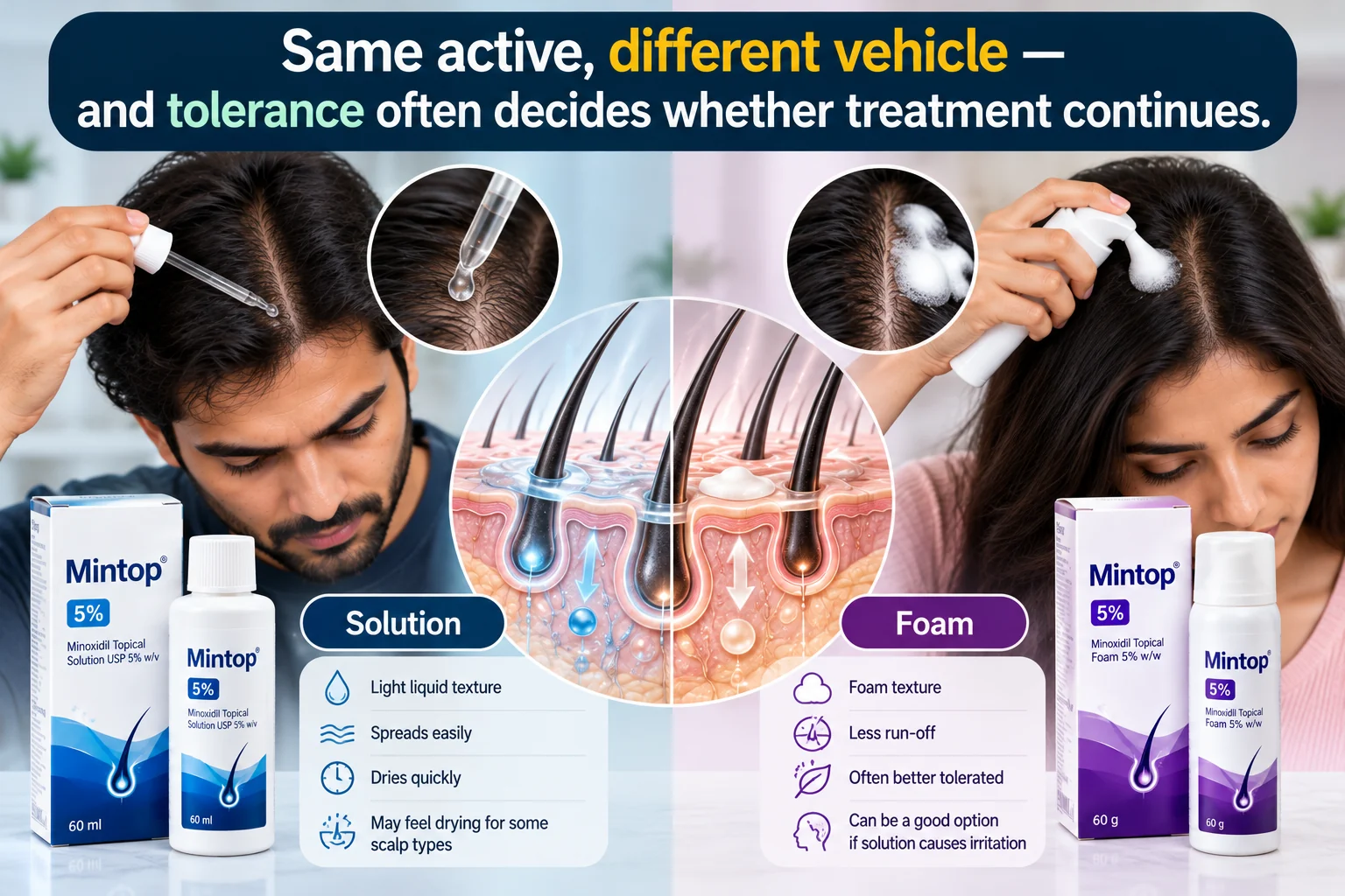 Mintop 5% minoxidil solution versus foam infographic showing liquid dropper and foam application, hair follicle illustrations, scalp tolerance differences and labelled product packaging.