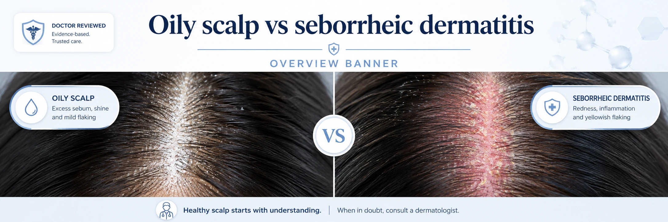Comparison summary — overview banner