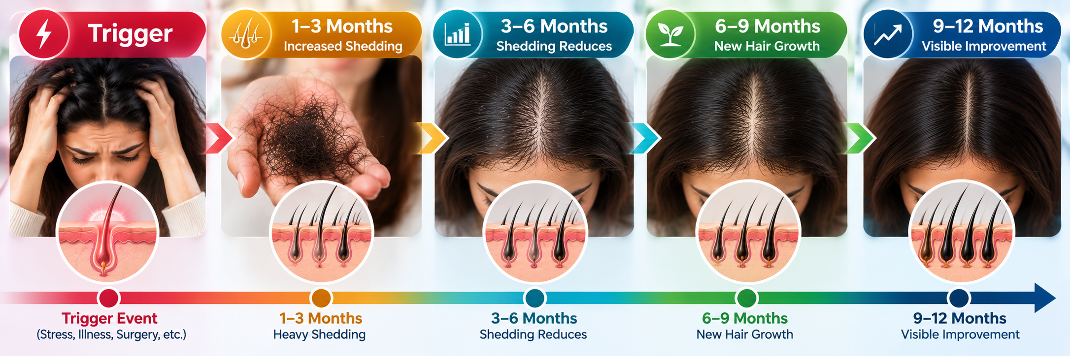 Telogen effluvium recovery timeline showing trigger, heavy shedding, reduced shedding, new hair growth and gradual regrowth over months