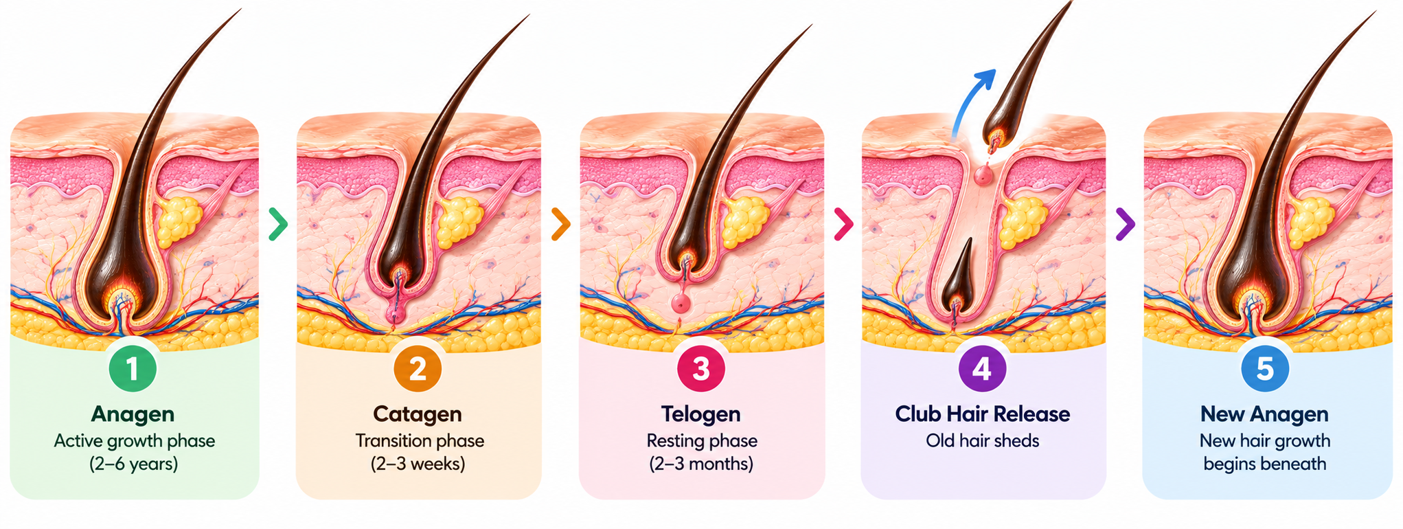 Sequence showing a club hair releasing as a new growing hair develops within the follicle.