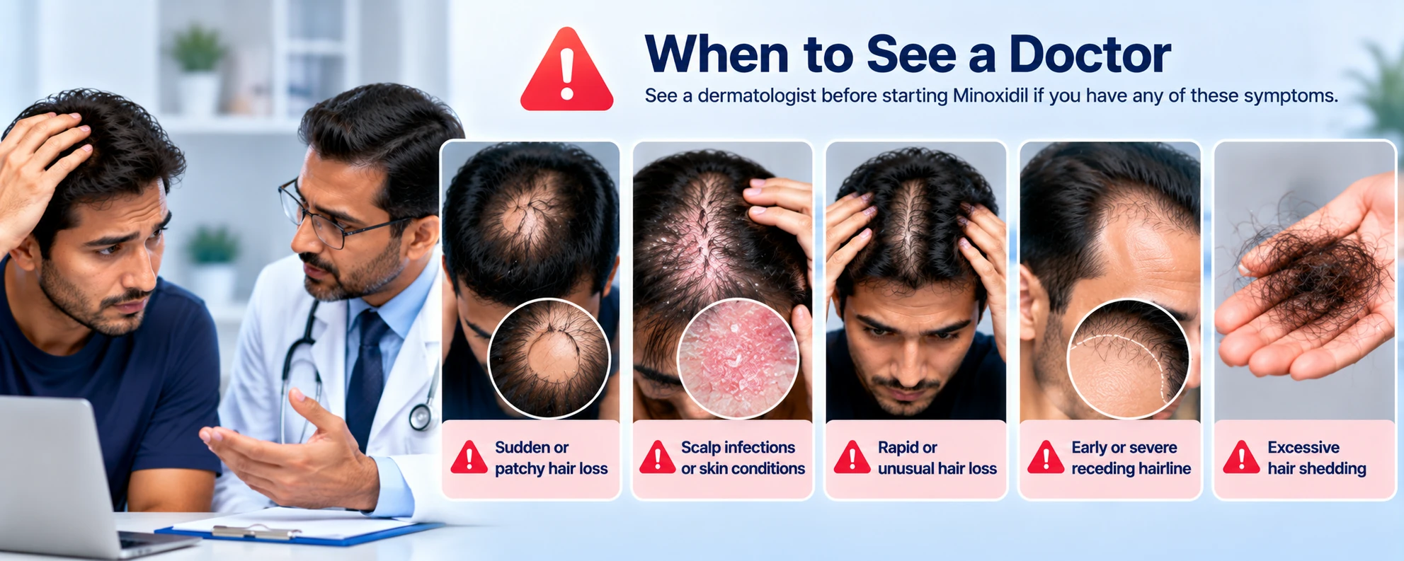 When to See a Doctor Before Using Minoxidil Minoxidil red-flag symptoms showing sudden patchy hair loss, scalp irritation, rapid hair loss, severe receding hairline, and excessive shedding requiring dermatologist assessment.