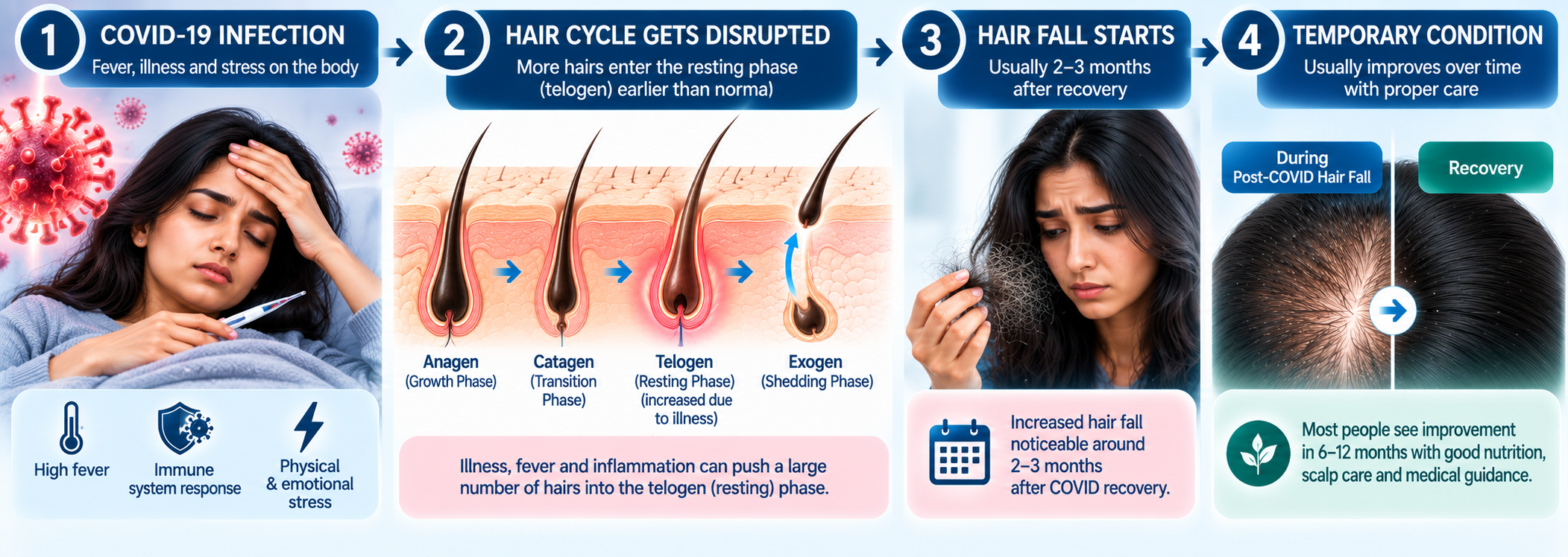 Post-viral acute telogen effluvium after COVID-19 illness and fever showing disrupted hair cycle and temporary shedding