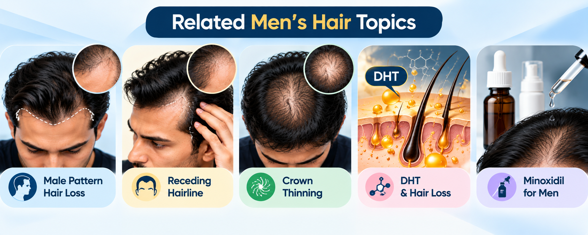 Related men’s hair topics including male pattern hair loss, receding hairline, crown thinning, DHT and Minoxidil
