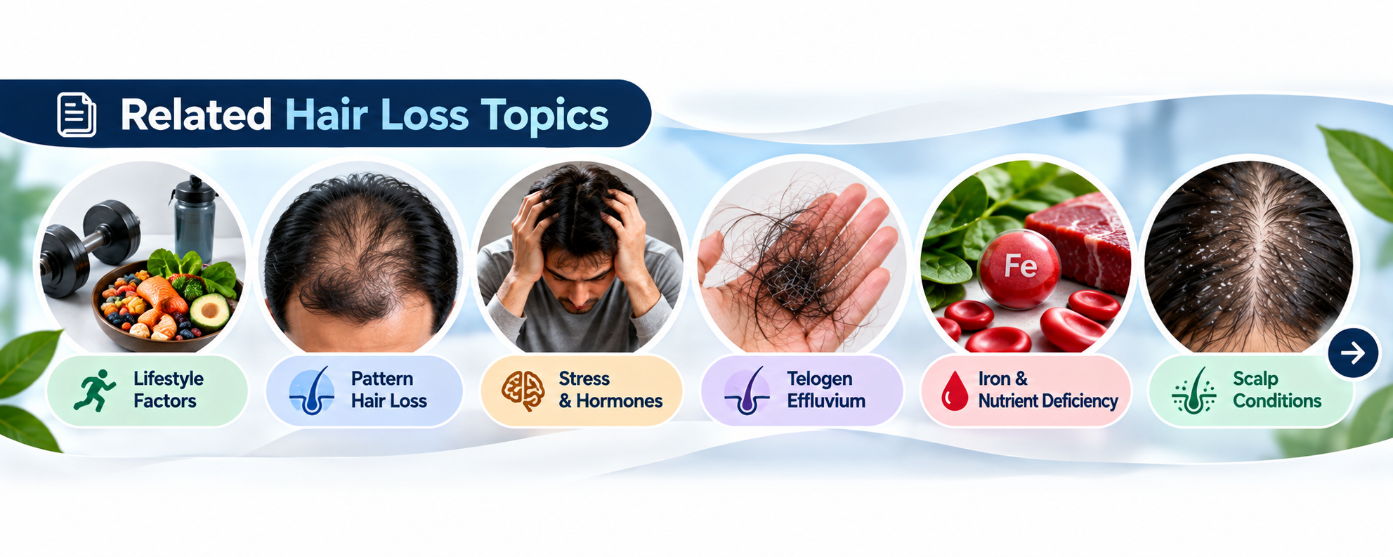 Related hair loss topics including lifestyle factors, pattern hair loss, stress, telogen effluvium, iron deficiency and scalp conditions