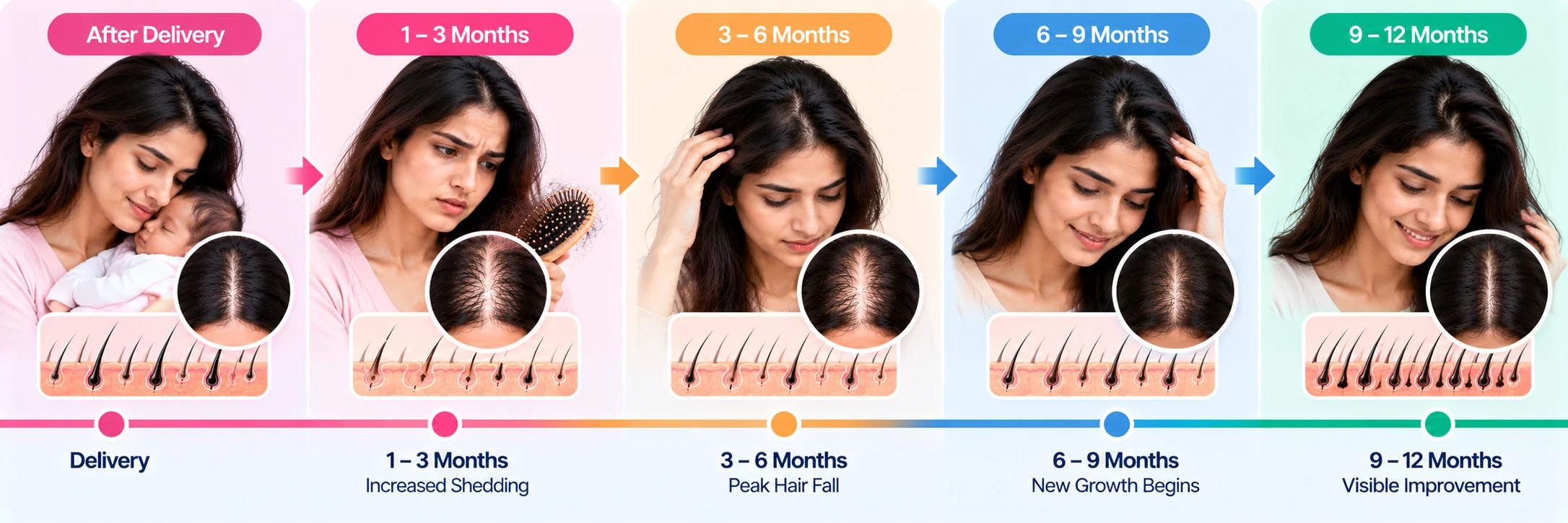 Postpartum hair loss recovery timeline from delivery through 12 months showing increased shedding, peak hair fall, new growth, and visible improvement.